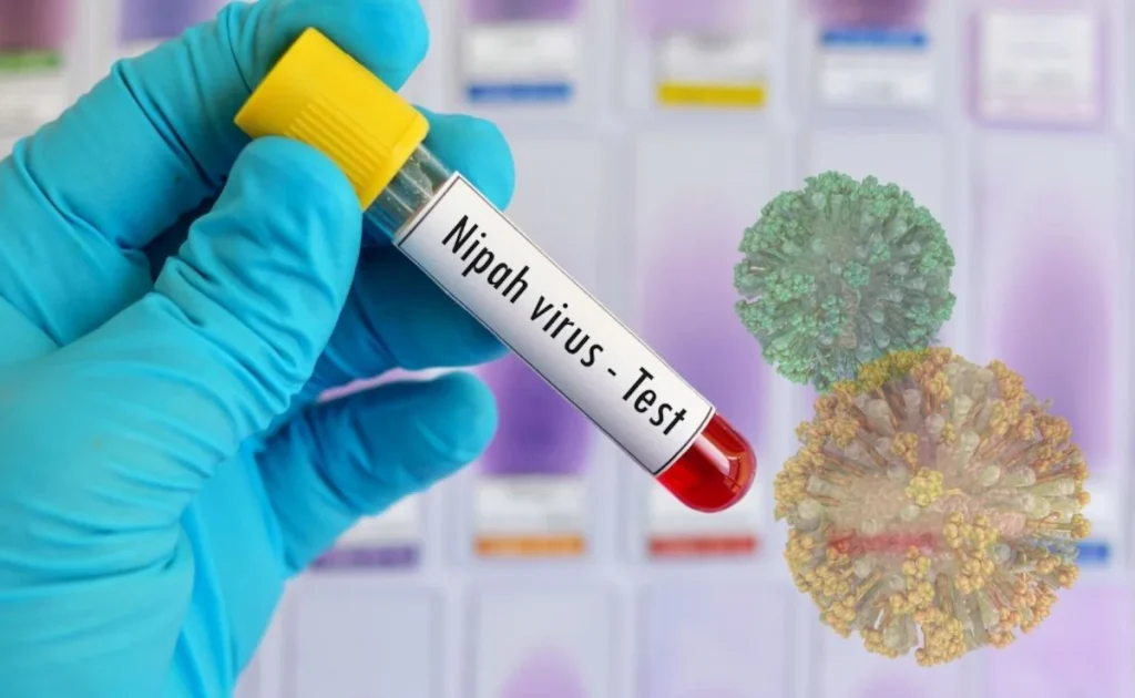 भारतसँगको सीमावर्ती क्षेत्रमा निपा भाइरसको जोखिमबाट सतर्क रहन आग्रह